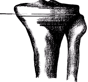 leg1sya.gif (28151 bytes)