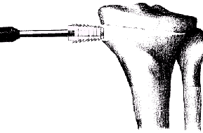 leg1syb.gif (28151 bytes)