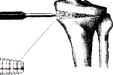 leg1syc.gif (28151 bytes)