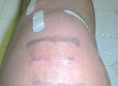 leg4.jpg (6795 bytes)