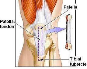 legacl2.jpg (21872 bytes)