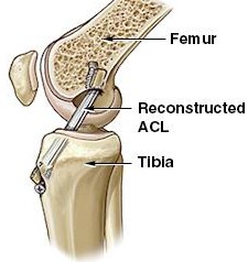 legacl3.jpg (14869 bytes)